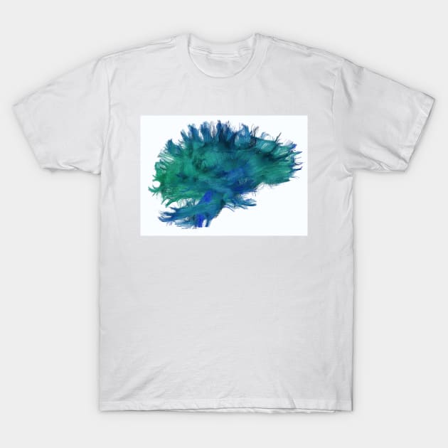 White matter fibres, DTI scan (C038/4656) T-Shirt by SciencePhoto